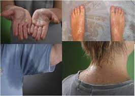 Bài thuốc trị ra mồ hôi tay chân