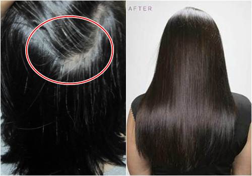 Làm sao để tóc đen lại không cần nhuộm?
